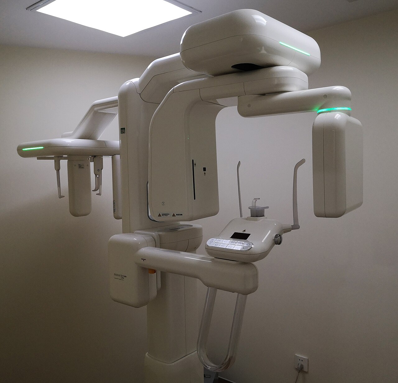 Scanner CBCT - imagerie 3D des fractures dentaires complexes